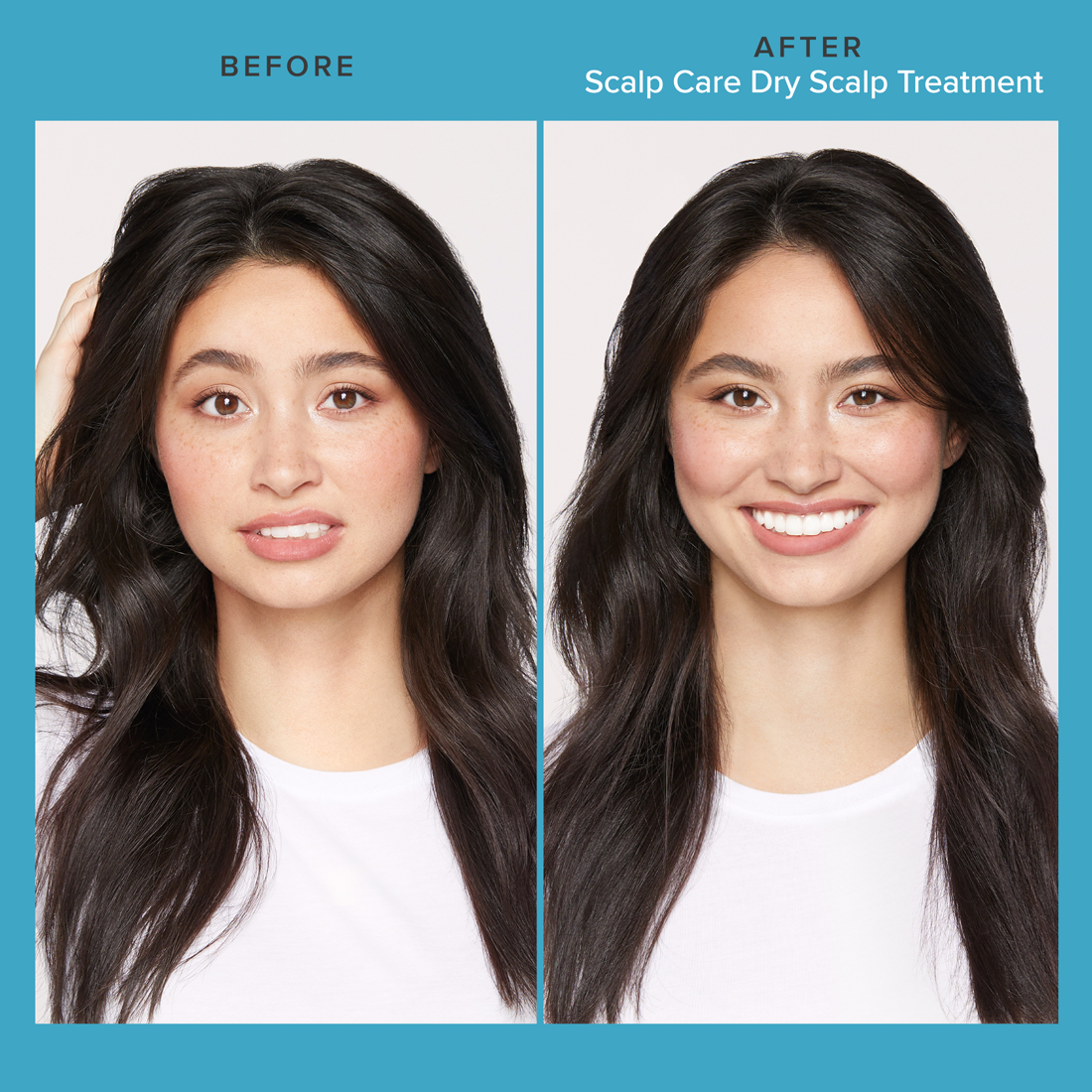 Scalp Care Dry Scalp Treatment 100 ml