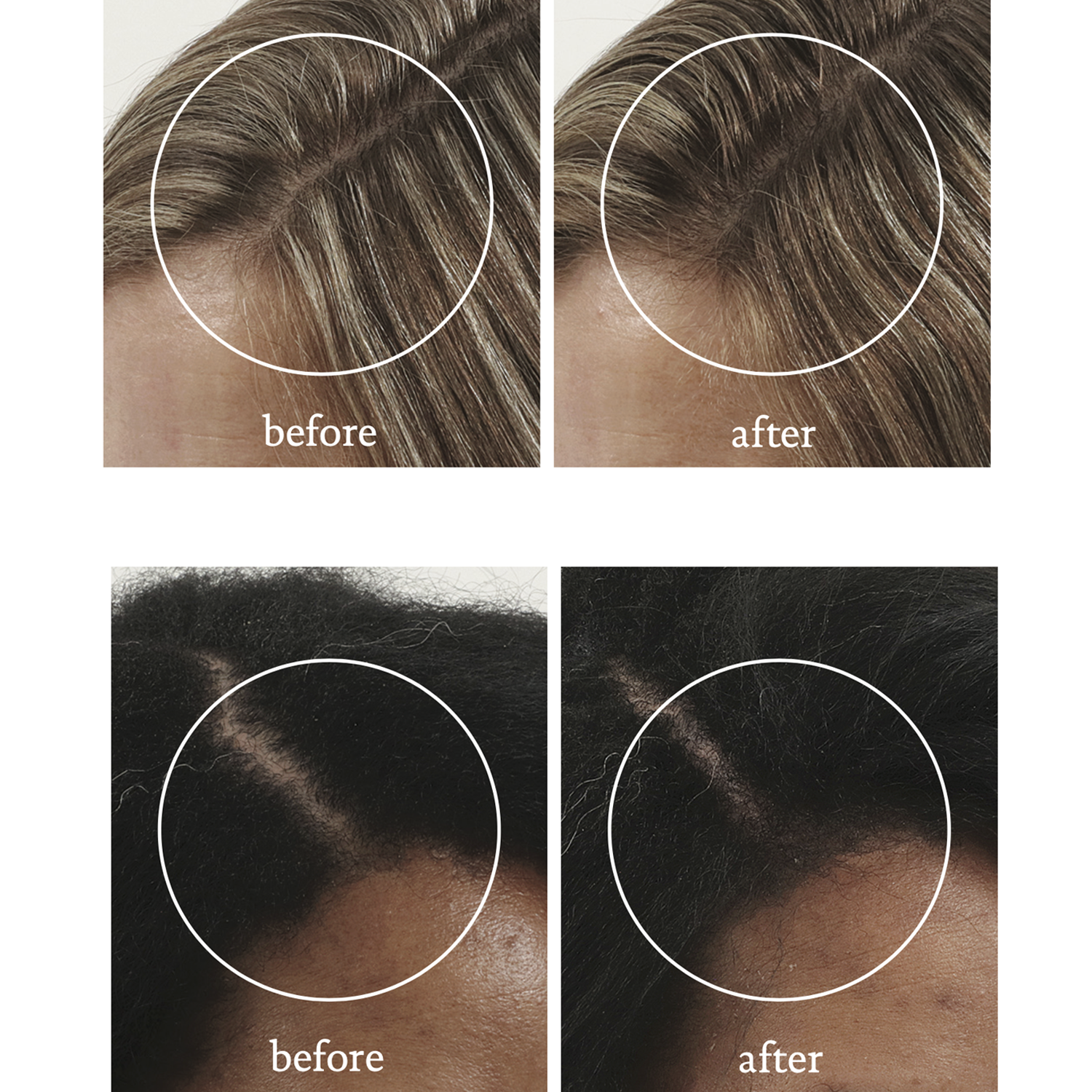 Scalp Care Revitalizing Treatment 73 ml